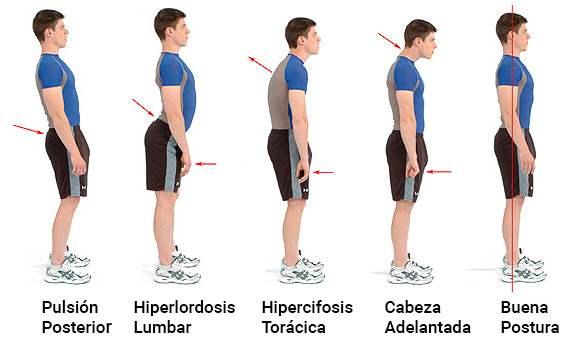 patrones posturales fisioterapia